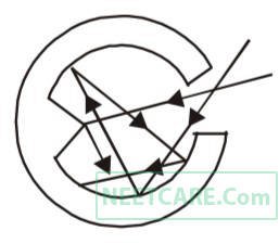 AIPMT 2002 Physics - Properties of Matter Question 31 English Explanation